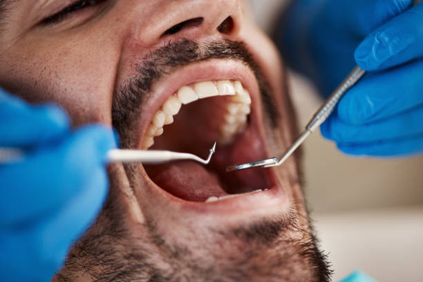 Best Broken or Cracked Tooth Emergency Dentist in Robertsde, AL